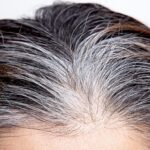 "White Hair के कारण और प्राकृतिक उपाय: जानिए सफेद बाल होने के कारण और इसे प्राकृतिक रूप से कैसे रोकें"
