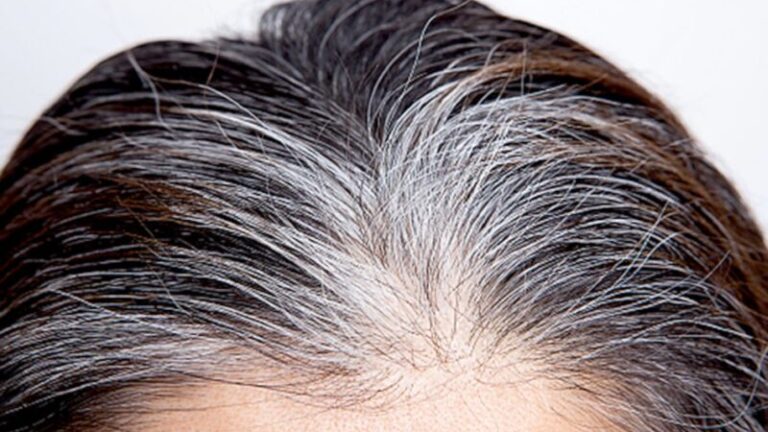 “White Hair के कारण और प्राकृतिक उपाय: जानिए सफेद बाल होने के कारण और इसे प्राकृतिक रूप से कैसे रोकें”